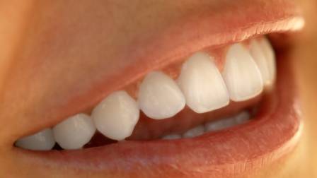 dientes